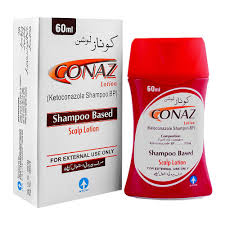Conaz Lotion Ketoconazole Shampoo BP scalp lotion anti dandruff shampoo Pakistan